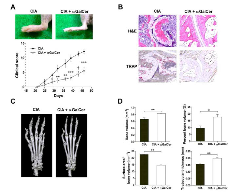 αGalCer에 의한 CIA의 염증 및 골파괴 억제
