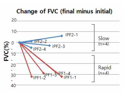 FVC