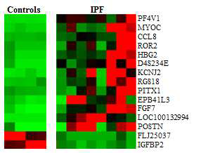 15 유전자 heat map