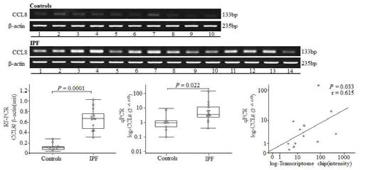 CCL8 mRNA 발현 (RT-PCR, qPCR)