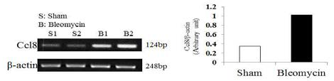 Bleomycin induced mice model에 서 Ccl8 mRNA level (RT-PCR)