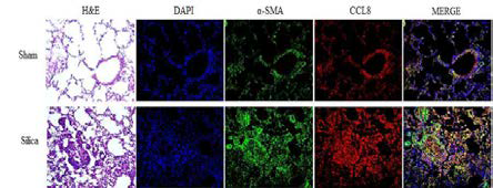 silica 주입한 쥐 모델의 폐 조직에 CCL8 Immunofluorescence stain