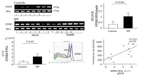 EPDR1 mRNA 발현 (RT-PCR, qPCR)