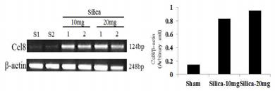 Silica induced mice model에서 Ccl8 mRNA level (RT-PCR)