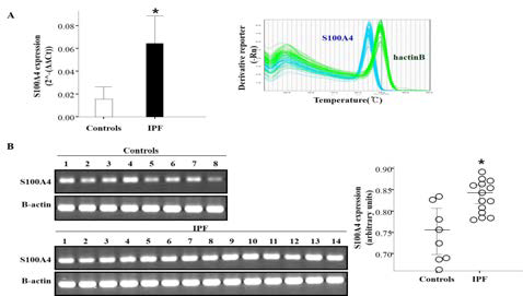 S100A4 mRNA level