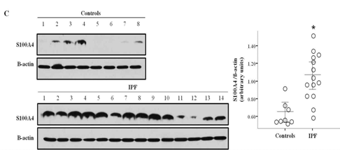 S100A4 protein level