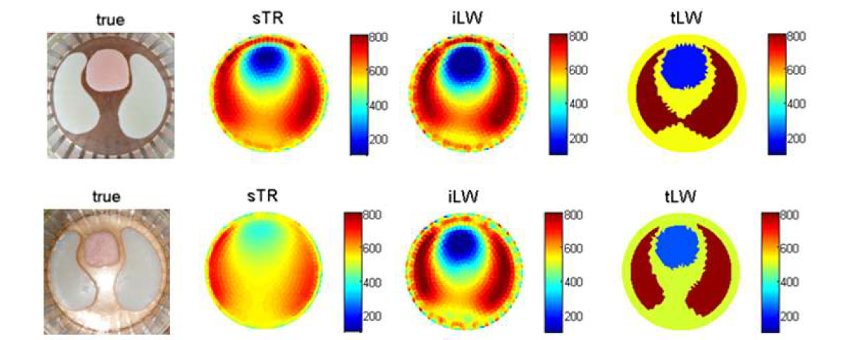 심장의 크기가 큰 경우(위)/ 작은 경우(아래)의 실험에 대한 복원 영상 (a) 실제영상, (b) sTR에 의한 복원 영상, (c) iLW에 의한 복원 영상, (d) tLW에 의한 복원 영상