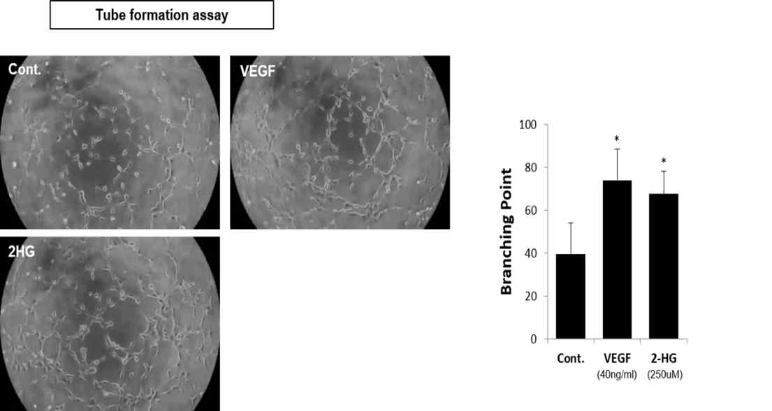 D-2HG에 의한 혈관내피세포의 혈관형성능 증가