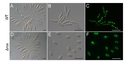 붉은곰팡이의 ROA 결손변이체의 유성포자 모양