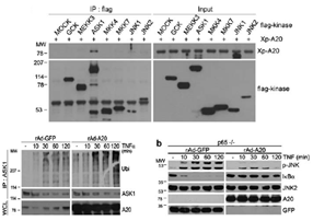 A20-ASK1 결합 및 ASK1의 Lys48 유비퀴티네이션에 JNK 활성조절 현상