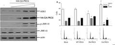 PKC-δ에 한 ASK1 발현 및 세포주기 변동
