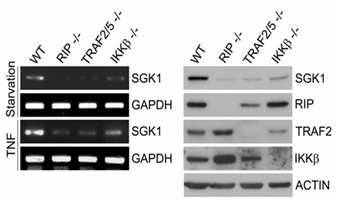 기능적 NF-κB deficient cell을 이용한 신규 NF-κB 타겟으로 SGK1의 발굴