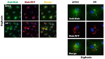 M. abscessus strain에 숙주 면역 반응의 특이성 관찰