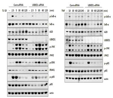 UBXD1에 의한 TNF 및 IL-1β에 의한 NF-kB 및 MAPK 활성도 비교