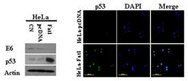 fat-1 gene expression cause inhibition of cell growth in human cervical cancer cells