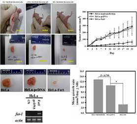 Inhibition of tumor growth of fat-1 stably transfected HeLa cells