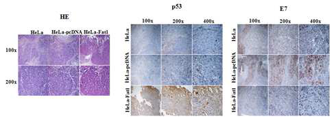 Constitutive expression of fat-1 gene decreased HPV-18 E7 expression in vivo