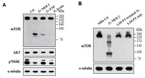 질편모충 metalloproteinase과 mTOR과의 연관성 분석