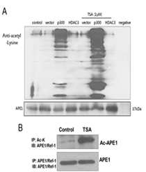 HADC 억제제인 TSA 처리에 따른 세포 내 APE1/Ref-1단백질 아세틸화