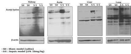 패혈증 유도 모델에서 조직별 아세틸화 증가 확인