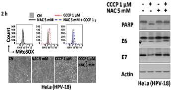 CCCP-produced ROS induces cell death and degradation of E6/E7 oncoprotein in HeLa cells