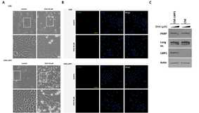 Apoptosis-inducing effect of DHA in NPC cells/NPC cells with LMP1 expression are more prone to apoptosis caused by DHA