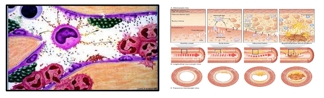 Vascular inflammation scheme