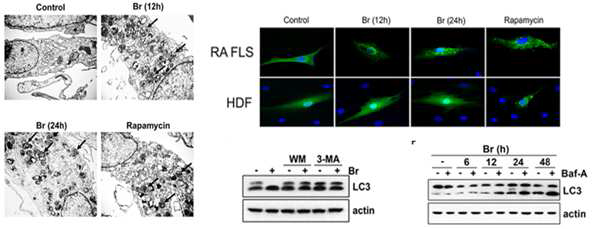 brazilin의 자가포식 활성 유도