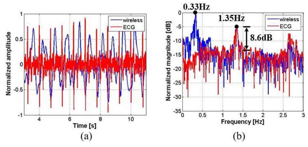 (a) 0.8 ~ 5Hz 디지털 밴드-패스 필터링을 한 후의 심박신호와 ECG 신호와의 비교