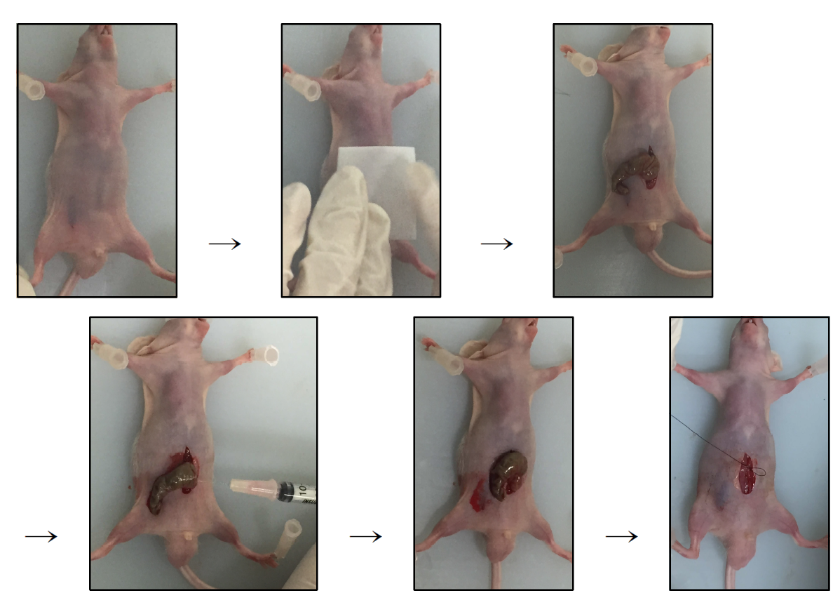 대장암 전이 모델(Orthotopic implantation mouse model) 구축 및 확립