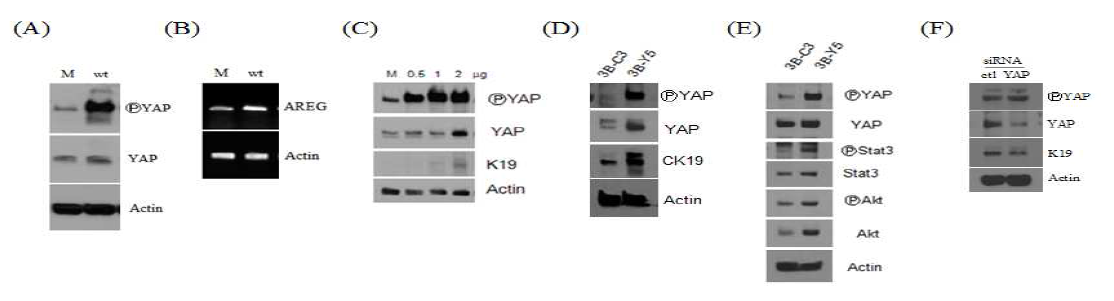 YAP의 과발현 및 발현 저하가 간암세포의 stemness, K19 발현 및 발현 조절기전에 미치는 영향 조사.