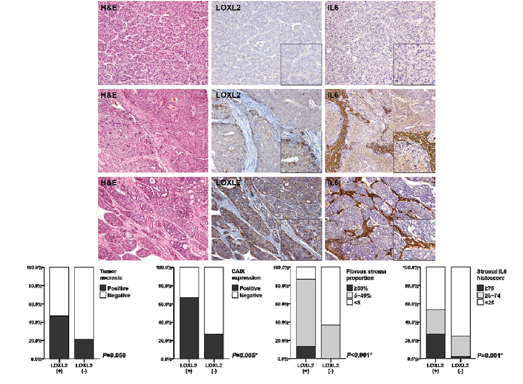 간세포암에서 LOXL2의 발현과 종양 미세환경 (fibrous stroma, hypoxia)의 연관성