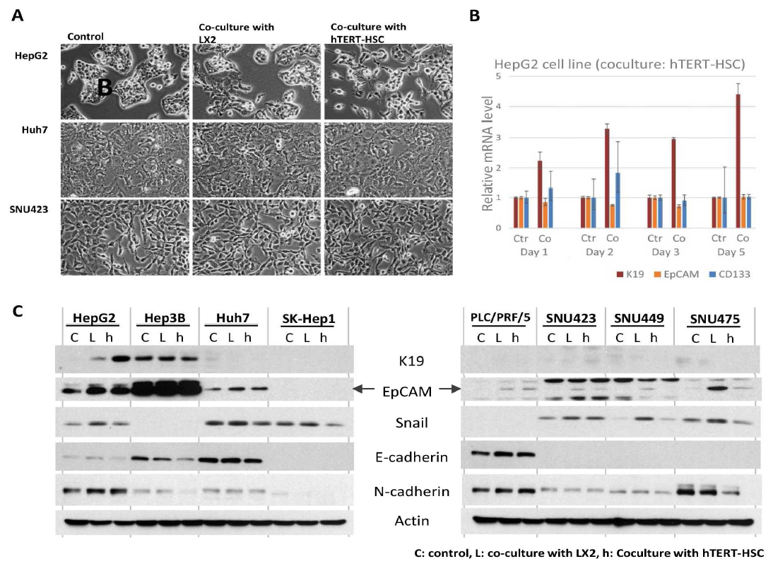 간암세포주와 간성상세포주의 co-culture시 나타나는 morphology 및 stemnss marker expression 변화