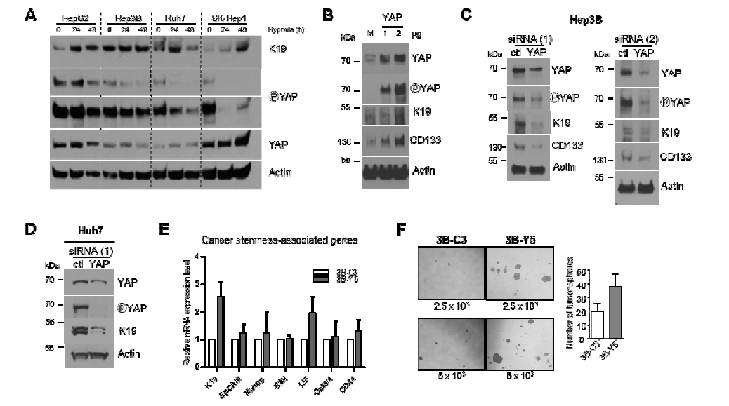 저산소증에서 YAP pathway의 활성화와, YAP의 활성화에 따른 간암세포주 관련 표지자의 발현 증가 및 tumor initiating capacity의 증가