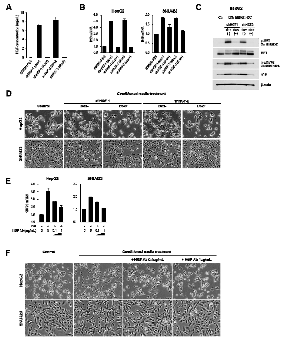 HGF regulation에 의한 K19의 발현 조절 및 간암세포주의 cell scattering 조절