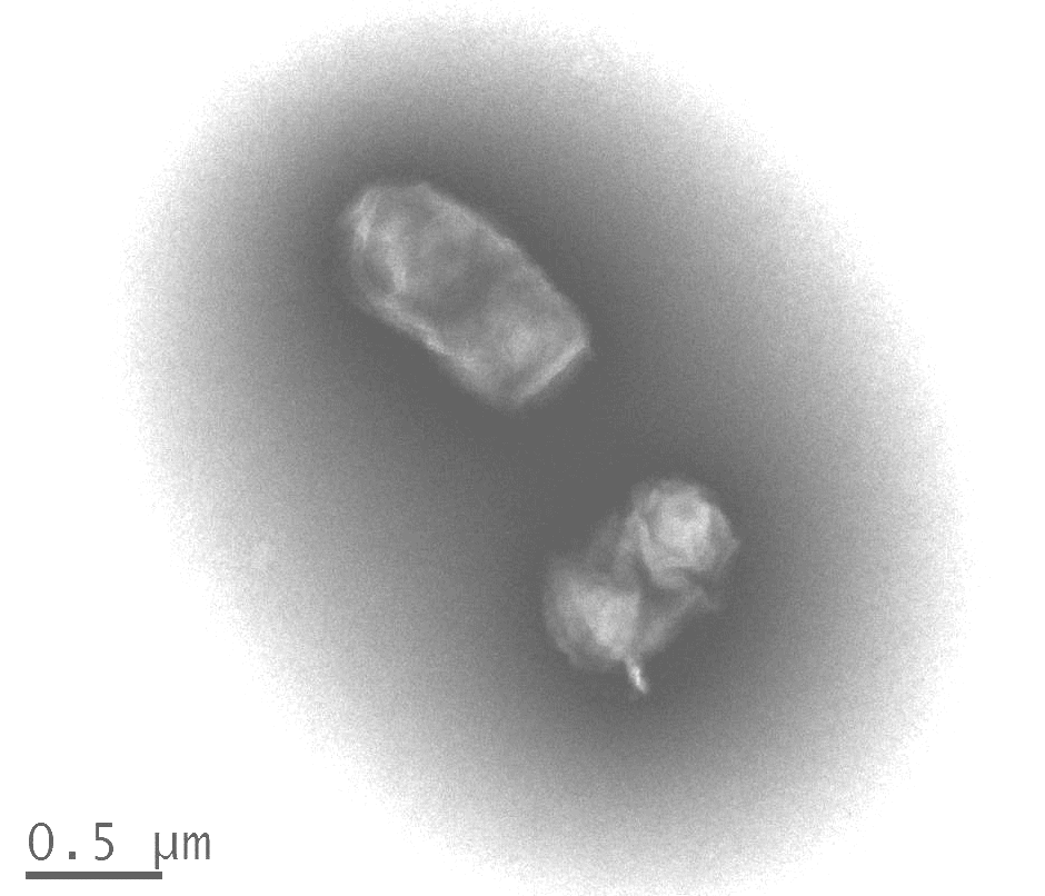 Desulfuromonas sp. TF의 투과전자현미경사진