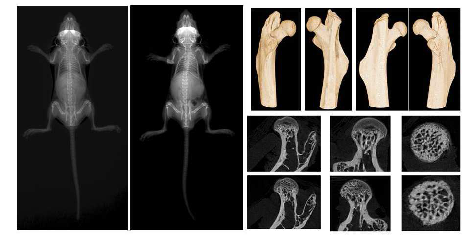 조골세포 특이 COMP-Ang1 과발현 마우스와 Cre-Recombinase가 없는 COMP-Ang1 마우스의 단 순 방사선 사진 및 microCT 소견