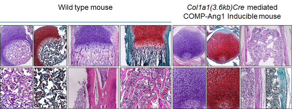 조골세포 특이 COMP-Ang1 과발현 마우스에서 혈관 형성증가 및 골형성 증가 소견이 관찰됨
