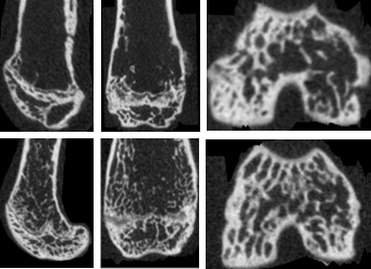 조골세포 특이 COMP-Ang1 과발현 마우스에서 대퇴골 허혈성 괴사 모델 제작 후, microCT 소견으 로 Cre-Recombinase가 없는 COMP-Ang1 마우스에 비해 허혈성 골괴사후 골파괴가 현저히 감소되며 골형 성 증가와 함께 관절의 형태가 잘 유지되고 있는 소견이 관찰됨.