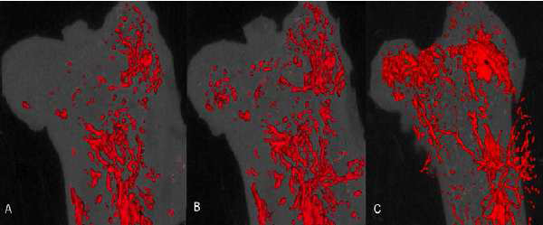 조골세포 특이 COMP-Ang1 과발현 마우스에서 대퇴골두 무혈성 괴사 모델 제작 후, microangiography 소견으로 Cre-Recombinase가 없는 COMP-Ang1 마우스에 비해 혈류 재형성이 증가된 소 견이 관찰됨.