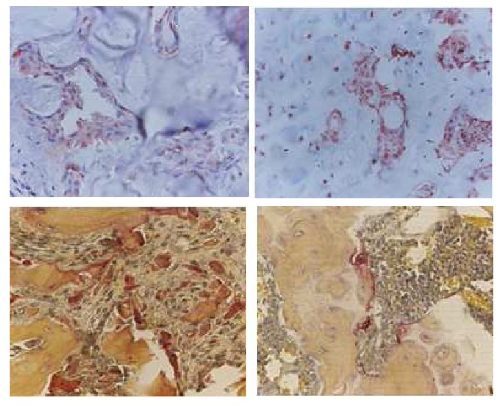 Cre-Recombinase가 없는 COMP-Ang1 마우스에 비해 과발현 마우스에서 허혈성 골괴사후 골형성 마커인 Osteocalcin의 발현이 의미있게 증가되며, TRAP 염색상 파골세포는 현저히 감소된 소견이 관찰됨