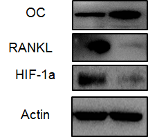 Western blotting 결과에서 Cre-Recombinase가 없는 COMP-Ang1 마우스에 비해 과발현 마우스에 서 HIF-1a 및 RANKL은 감소하는 반면 골형성 마커인 Osteocalcin은 증가하는 소견이 관찰됨