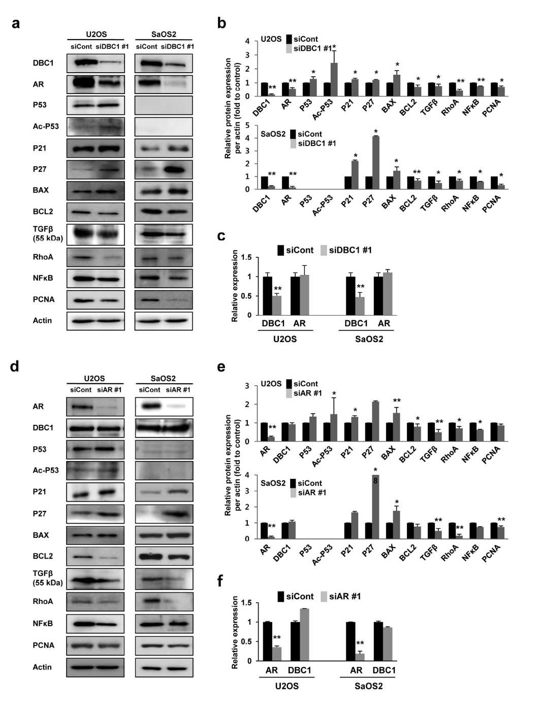 Western blotting 결과에서 DBC1 knock down후, BCL-2, TGF-B, RhoA, NF-kB, PCNA는 감소 하는 반면 P21, P27은 증가하는 소견이 관찰됨