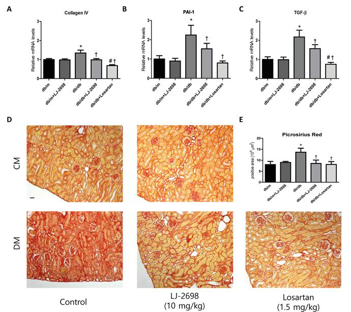 당뇨 db/db 생쥐의 콩팥 섬유화에 미치는 LJ-2698의 억제효과