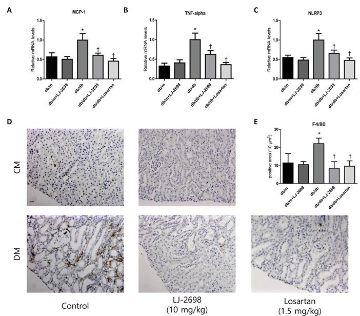 당뇨 db/db 생쥐의 콩팥 염증반응에 미치는 LJ-2698의 억제효과