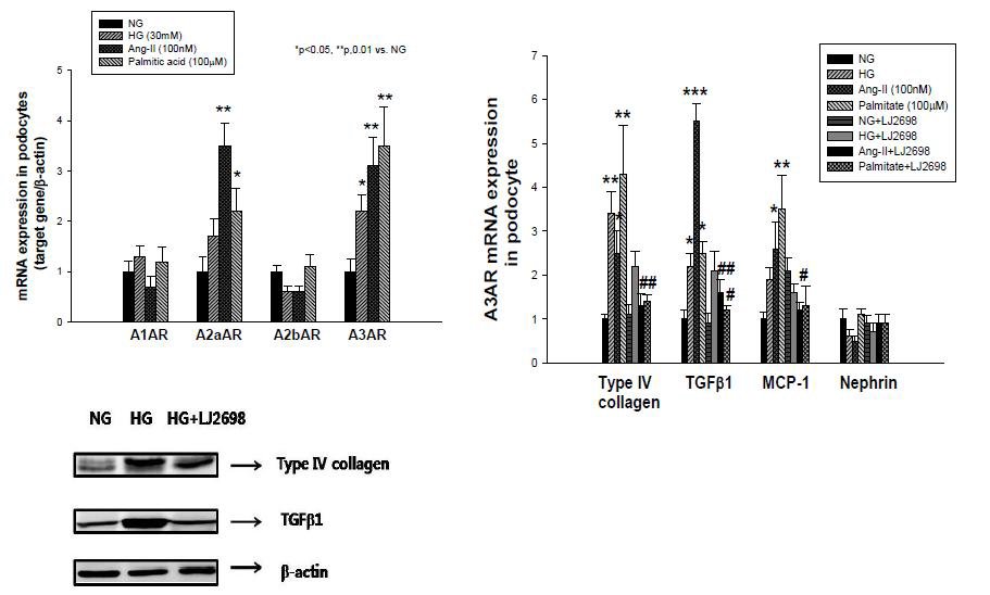 사구체 족세포에서 아데노신수용체의 발현 및 A3AR 길항제의 효과