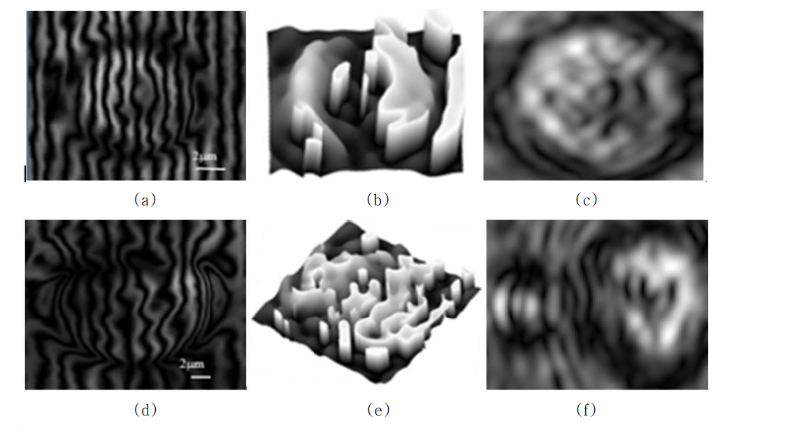 (a, d) shearing interferograms (b, e) RBC gradient phase image retrieved from shearing interferograms in (a) and (d), respectively (c, f) RBC gradient amplitude image retrieved from shearing interferograms in (a) and (d) respectively (a, b, c) are from a healthy RBC, while (d, e, f) are from a malaria infected RBC