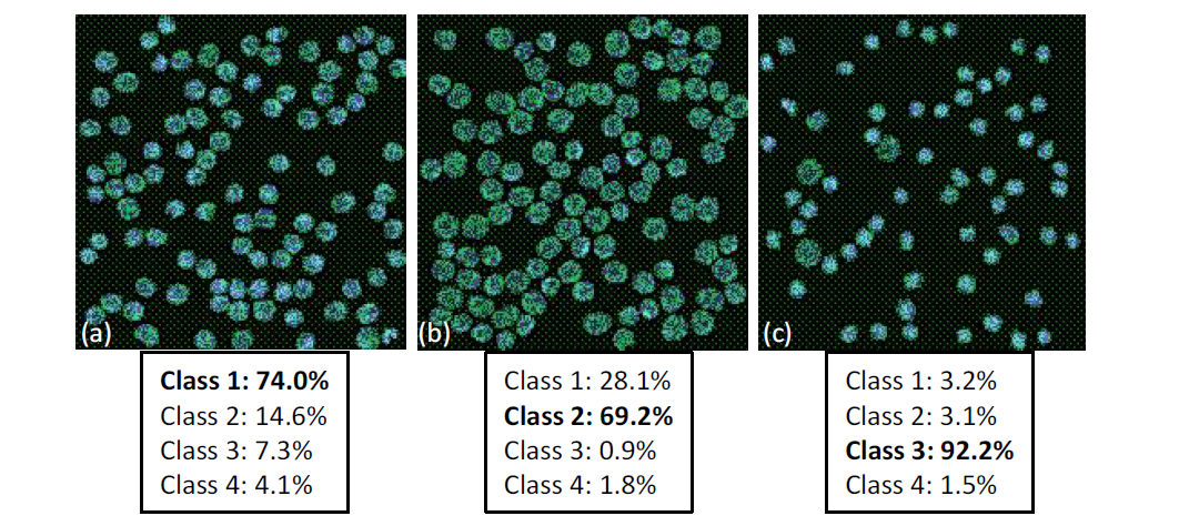 Analysis of reconstructed phase image with multiple RBCs (a), (b), and (c) are segmented images with percentages of each type of RBC labeled by our designed classifier method