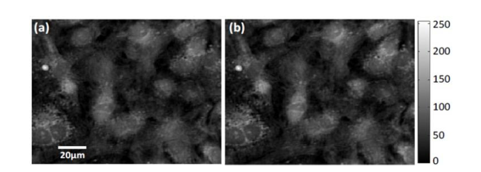 The optical path difference images of cardiomyocytes captured at different times (a) Cardiomyocyte OPD image at the minimum of peaks (b) Cardiomyocyte at the maximum of peaks