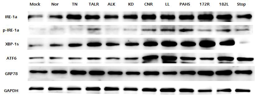 The cytokines analysis related to ER stress using western blot assay. After transfection 10 mutants into HuH-7 cells, the immunoblotting assay was conducted using the cytokines related to ER stress pathway including IRE-1a, p-IRE-1a, XBP-1s, ATF6, and GRP78